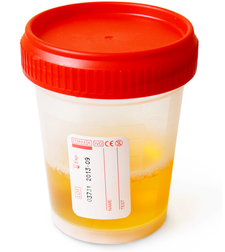 Urine Infection test
